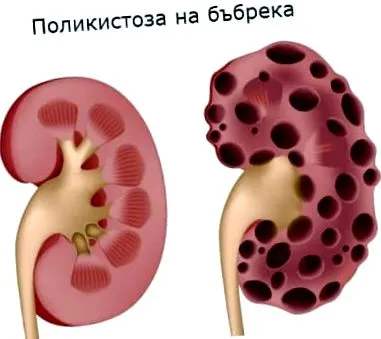 klinikai patológia