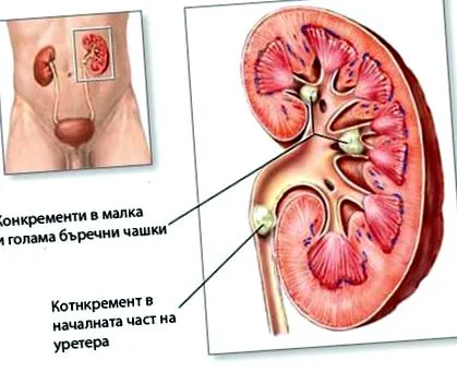 vesekövek általános