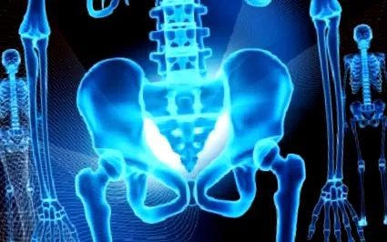 csípőízület csípőízület arthrosis