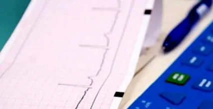 tachycardia