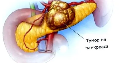 daganatokban klinikai