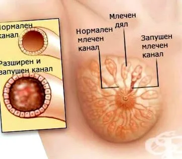 lehetőség hogy tejcsatornák