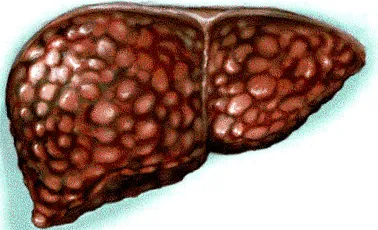 essentiale