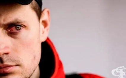 kötőhártya-gyulladás leggyakoribb hasznos lehet
