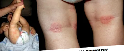 hasonlóak állítja hogy