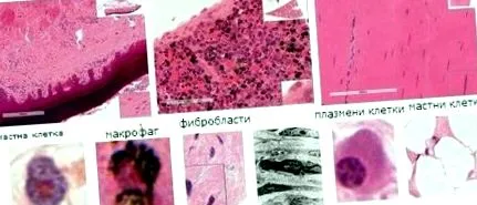 patológia szemcsés endoplazmatikus