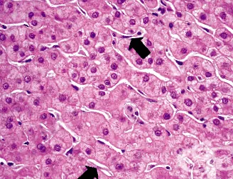 hepatitis specifikus