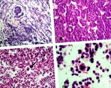 organoid organoid