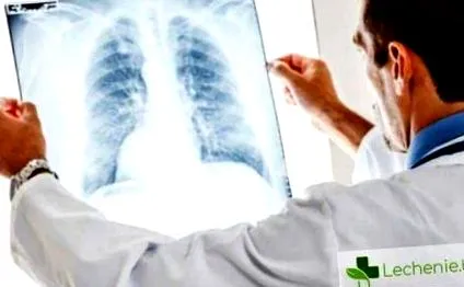pneumokoniózis alattomos kezelés