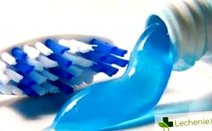 vagy fluorid