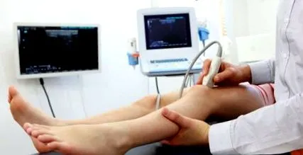 osteopetrosis