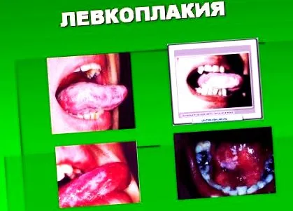 családok tagjai előtti állapot