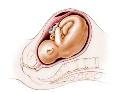 placentae placenta