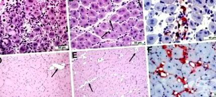 emberi test