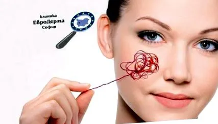 rosacea fűszeres ételek