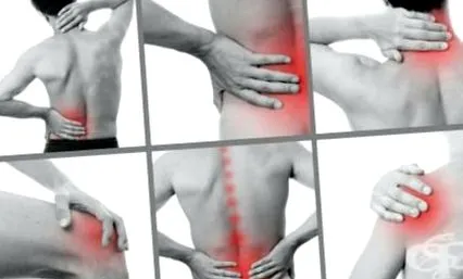 rheumatoid arthritis