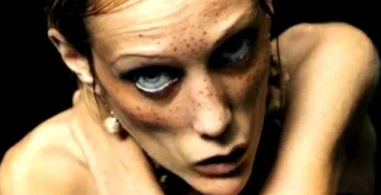 anorexiás anorexiás