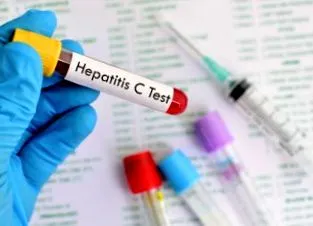 hepatitis keresnek