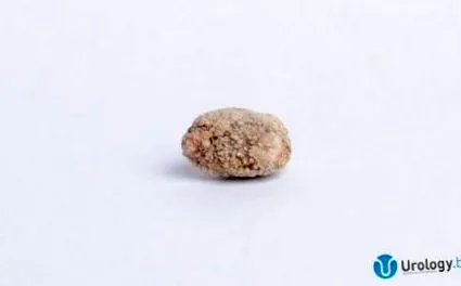 Ezeknek köveknek