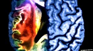 alzheimer-kórt