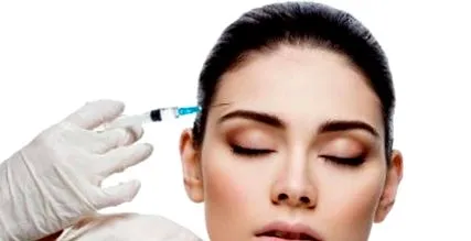 Botox alkalmazásának Botox alkalmazásának