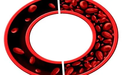 active