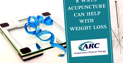 acupunctură