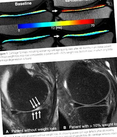 rsna