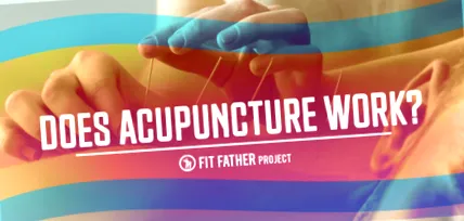 acupunctura