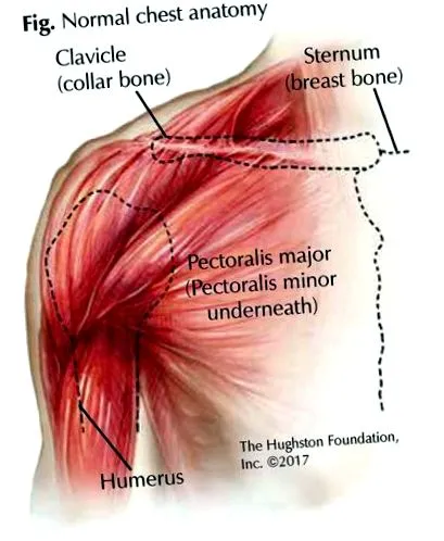 pectoralis
