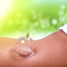 cupping