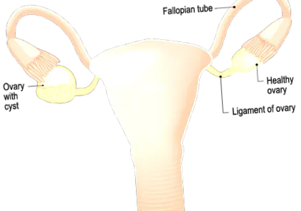 simptome