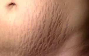 vergeturile