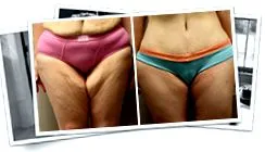 thighand