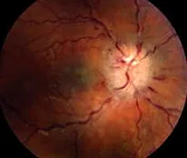 eyeworld eyeworld