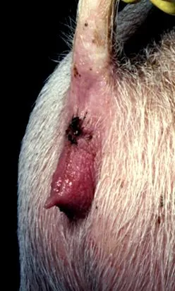 hiperestrogenizmus