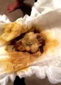 какашок