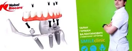 імплантати