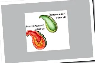 бескаменний холецистит