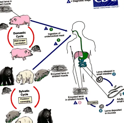 biológia trichinellosis