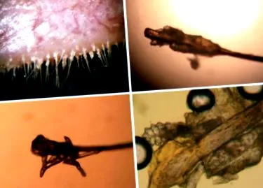 Demodex fertőzés
