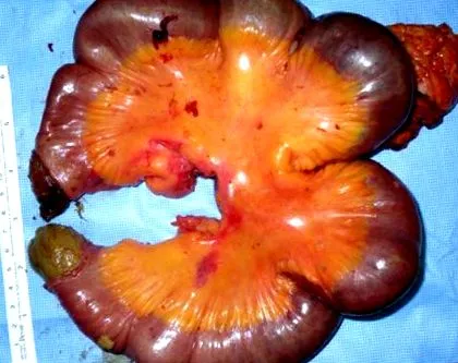 харчування