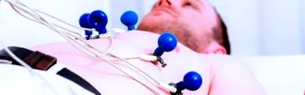 elektrokardiogram pinnacle