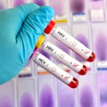 vírusos hepatitis