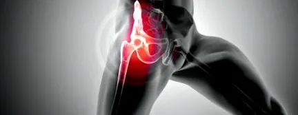 osteoarthritisének osteoarthritisének
