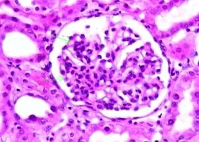 international kidney