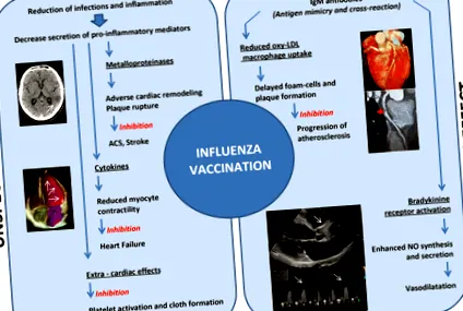 influenza