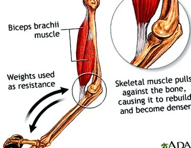 medlineplus osteoporosis