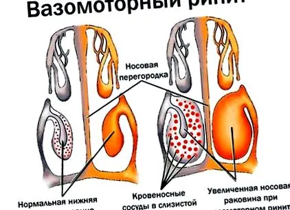 лікування