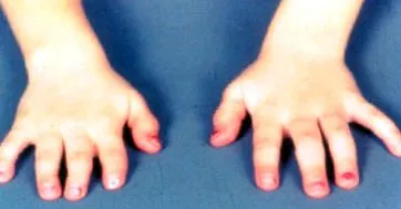 musculoskeletal
